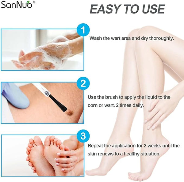 SANNUO Liquid Wart Remover for Common and Plantar Warts, Fast Acting Gel Wart Remover Suitable for All Skin Types, 0.67 FL OZ